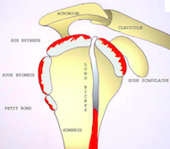 LA COIFFE DES ROTATEURS -l'ensemble des muscles et des tendons