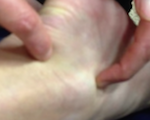 60V se trouve entre le tendon Achille et l'os externe du pied. 62V sous la malléole externe.