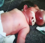 L’arrosage des champs avec des pesticides touche la santé de milliers de paysans et de leurs enfants.